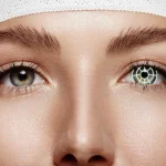 Cataracte 2025 – Chirurgie moderne et maîtrise des risques
