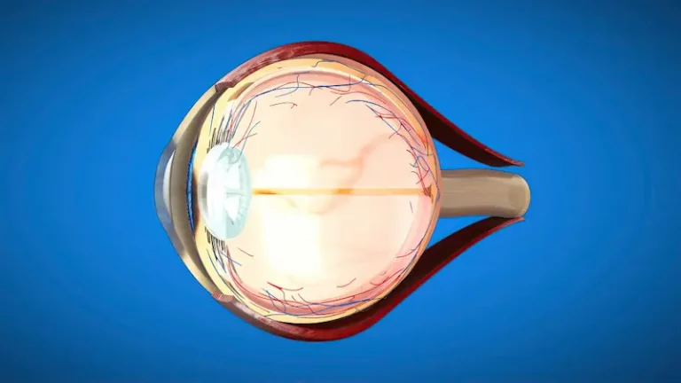Cataracte 2025 : diagnostic précoce et signes d’alerte