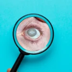 La cataracte s’opère-t-elle au laser ?