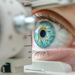 Opération laser des yeux : temps de récupération réel (jour par jour)